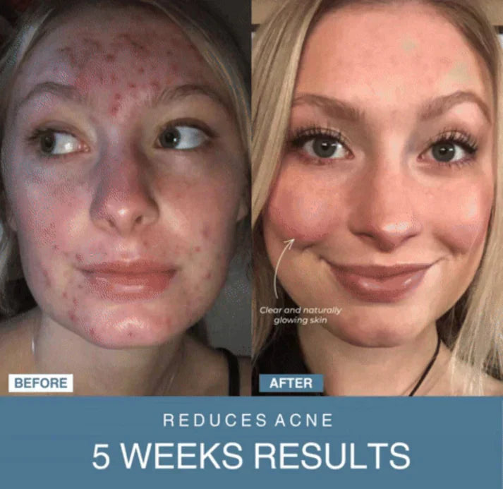 Shop Shuffle 7-in-1 LED Anti-Aging/Wrinkle Apparatus