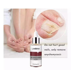 Lanbena - Nail Repair Essence (Original)